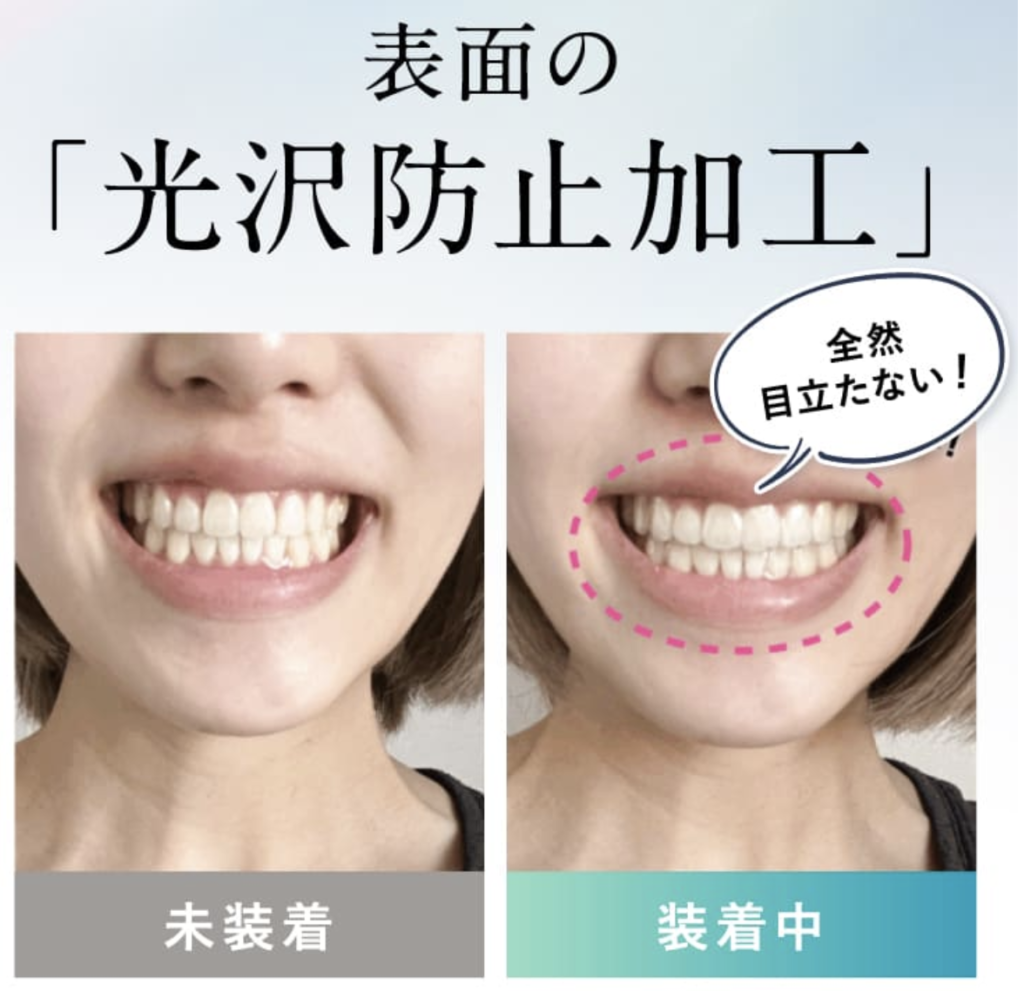 ウィ・スマイル矯正光沢防止加工イメージ図